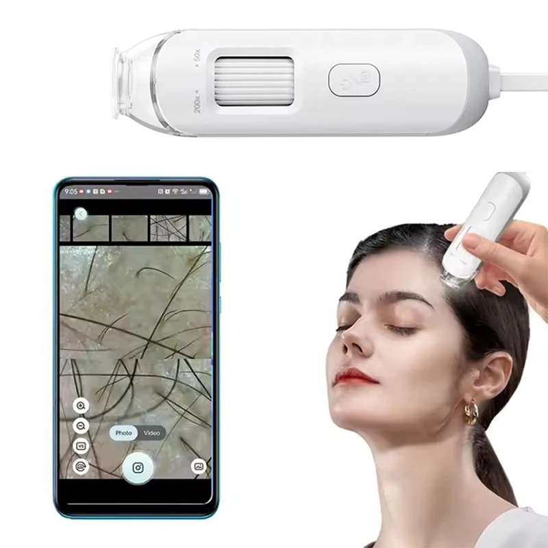 Hair Porosity Test - NEUES Elektronisches Dermatoskop Kopfhautkamera Professioneller Gesichtshaut-Analysator