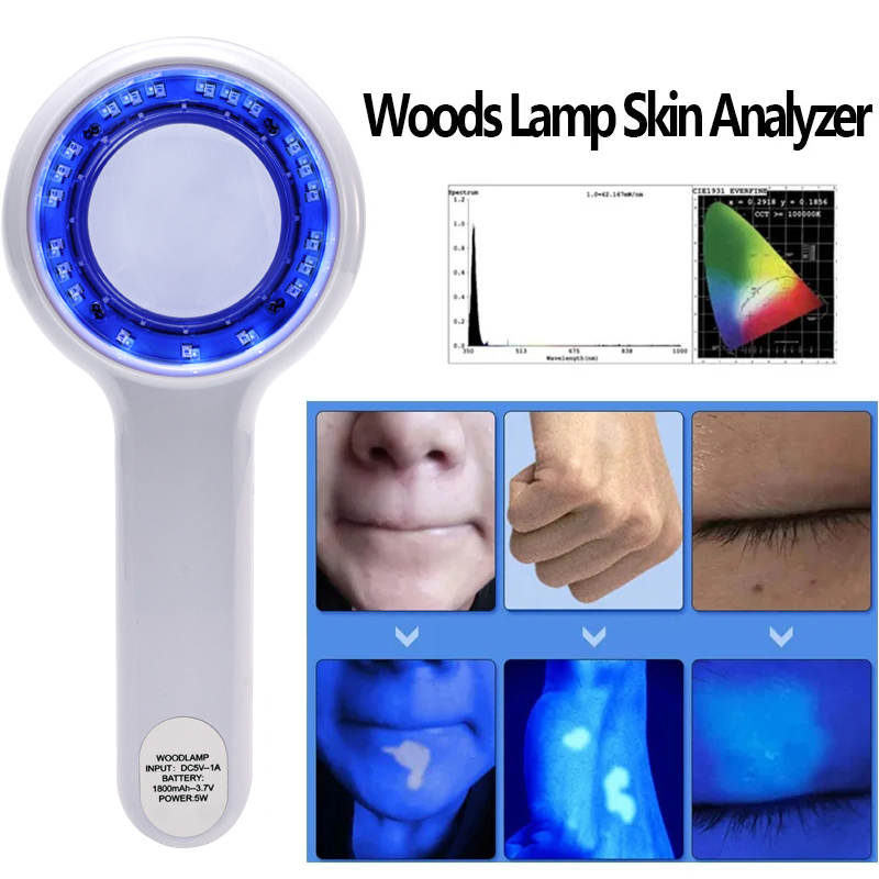 Hair Porosity Test - NEU Woods Lamp Hautanalysator Tragbarer Gesichtssalon