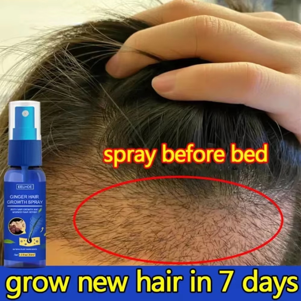 Hair Care Nature - Schnelles Ingwer-Haarwuchsspray für Wurzelwachstum, Anti-Haarausfall, Haarwuchs-Serum,