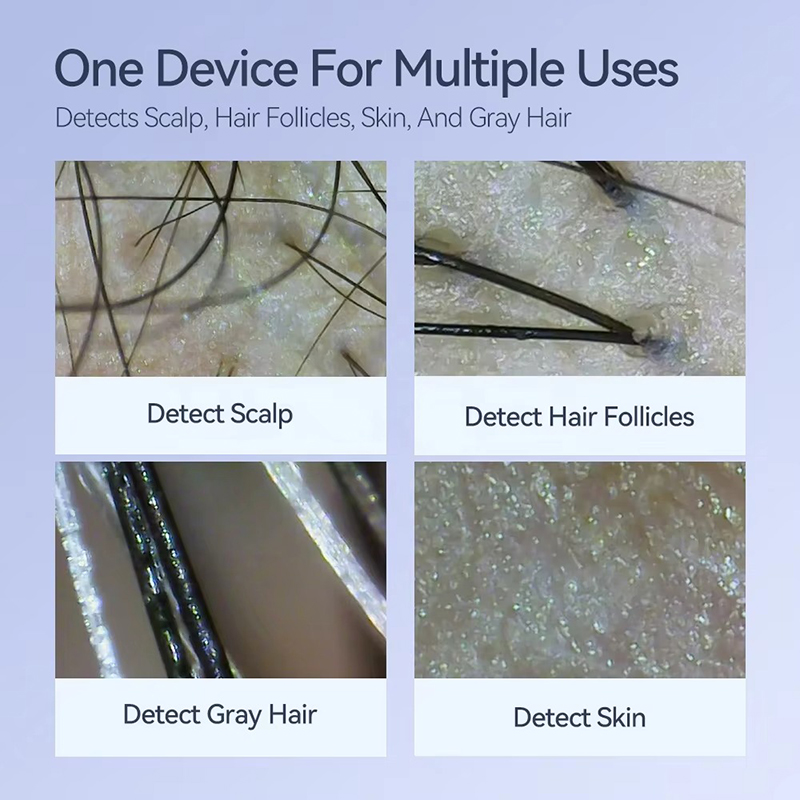 Neue Haut Haar Kopfhaut Detekt – Hair Porosity Test Bewertung und Preis