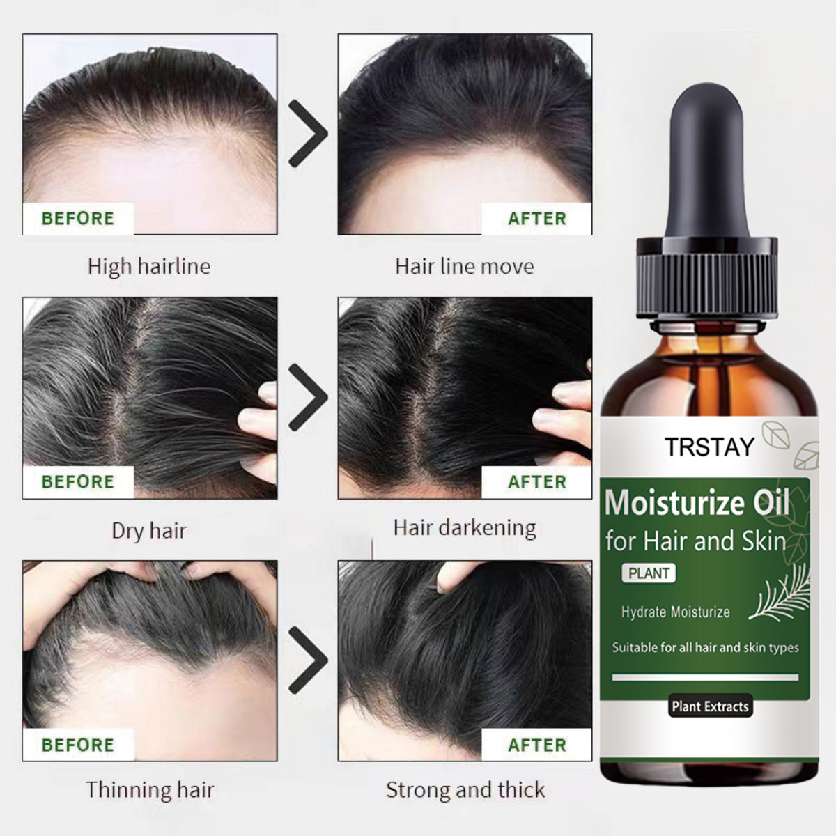 TRSTAY Ätherisches Rosmarinöl, – Rosemary Hair Oil Bewertung und Preis