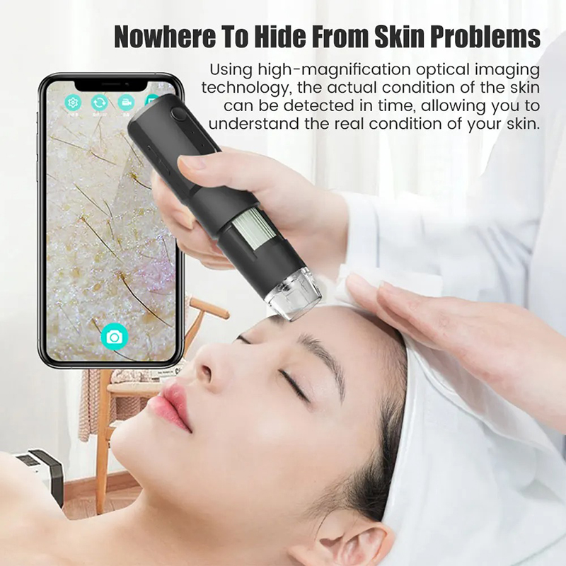 Drahtloses Dermatoskop, Kopfha – Hair Porosity Test Bewertung und Preis